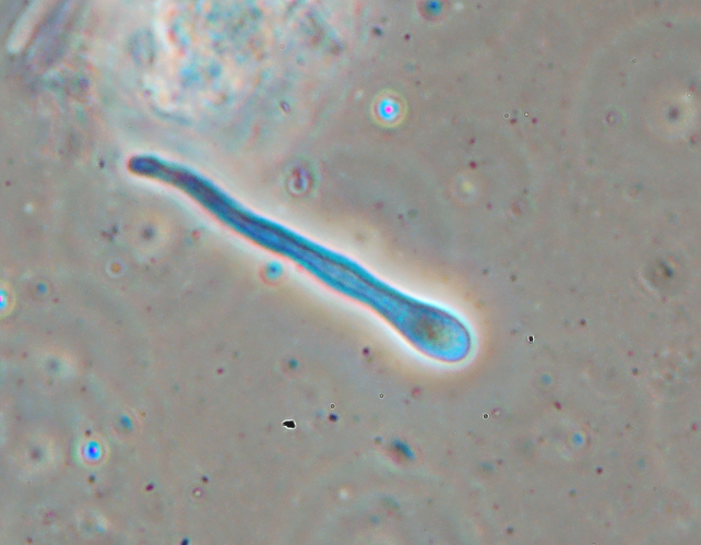 Fotoreportage di uno Stereum (credo!) (Stereum gausapatum)
